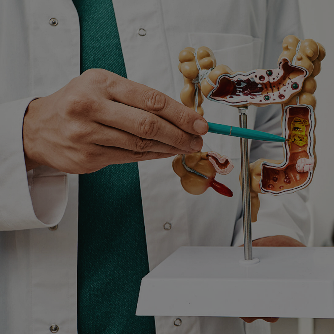 CDV - Gastroenterology-4